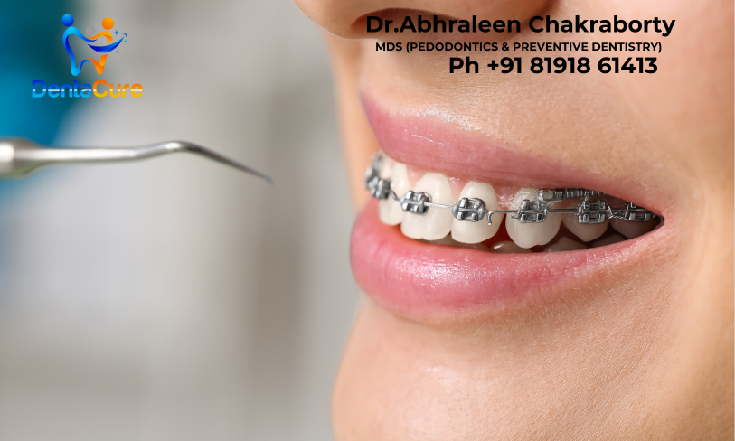 best brace treatment in tollygunge