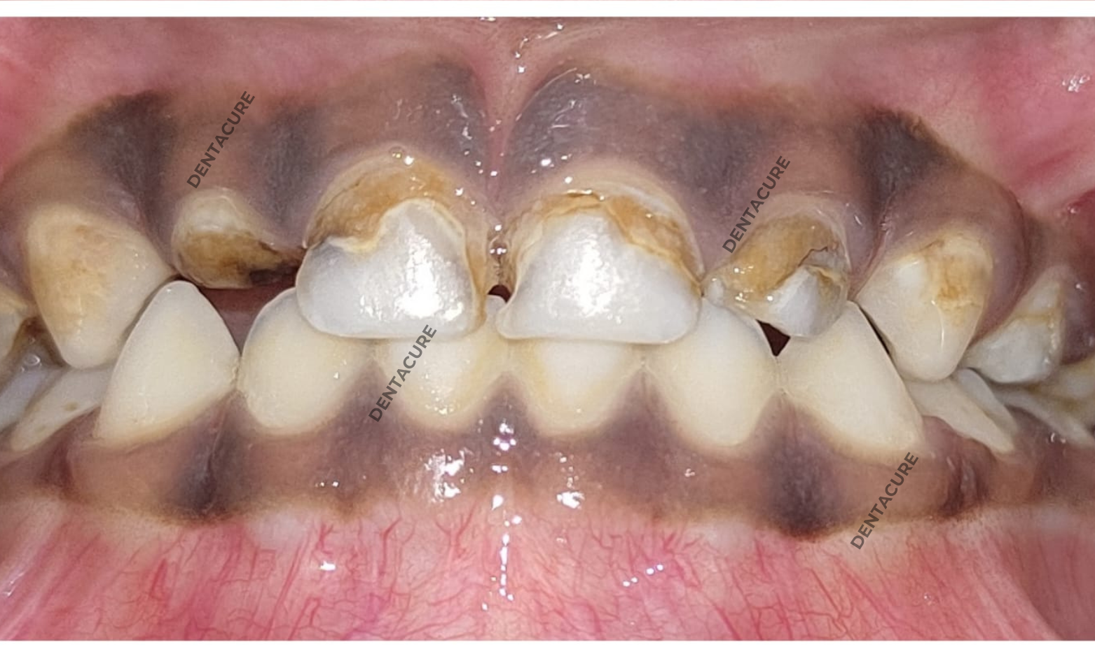 DEnta cure service (3)