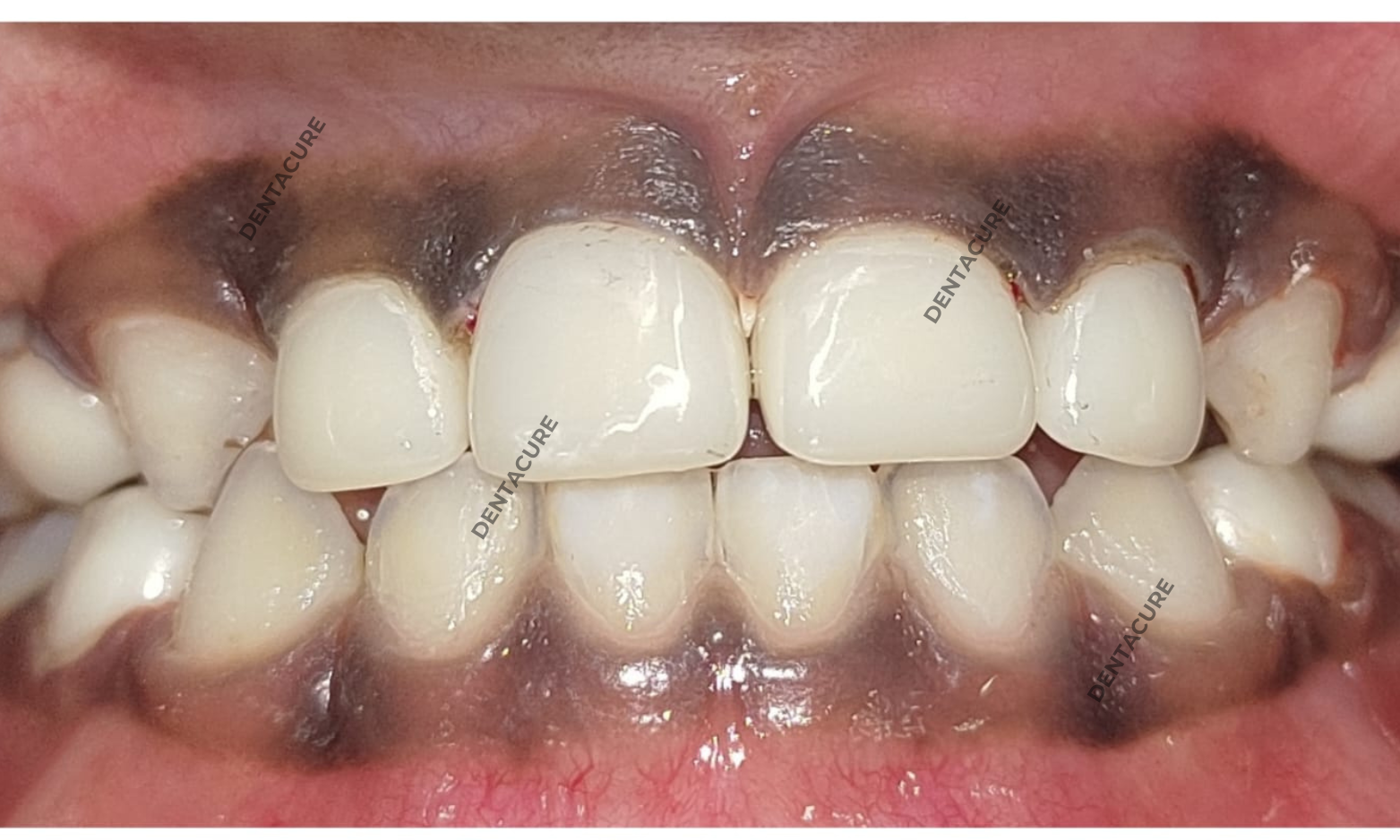 DEnta cure service (4)