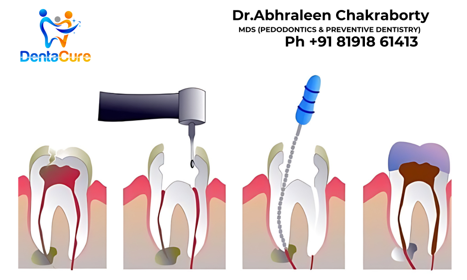 pulpectomy treatment in kolkata